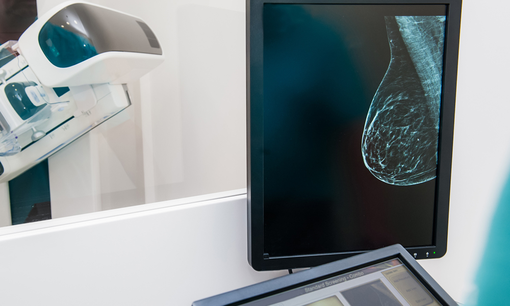 mammogram on computer screen